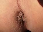 Anus Closeup